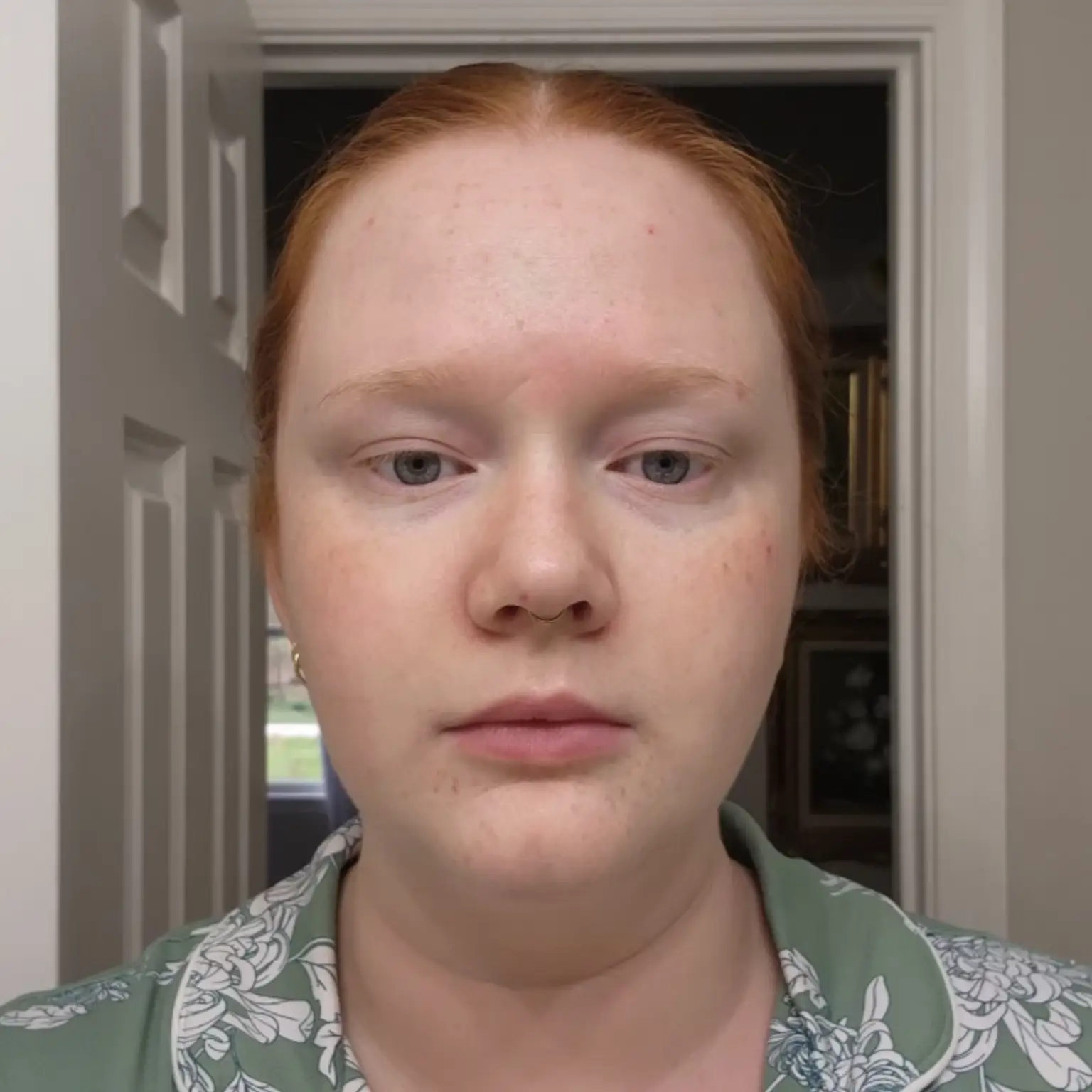 5 Days After XERF